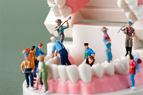 かわらい歯科医院の予防